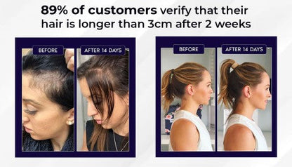 🌿AKTION ZUM LETZTEN TAG – 50 % RABATT🌿 HZA™ Natürliches Haarwuchsspray