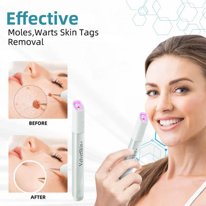 ☂DedMuller® VelvetSkin+Series ⚔️All-in-One Laser Eraser Pen🖊️ (🔬Powered by CO₂ laser technology – effectively removes moles, warts, skin tags, pigmentation spots, and other skin imperfections)